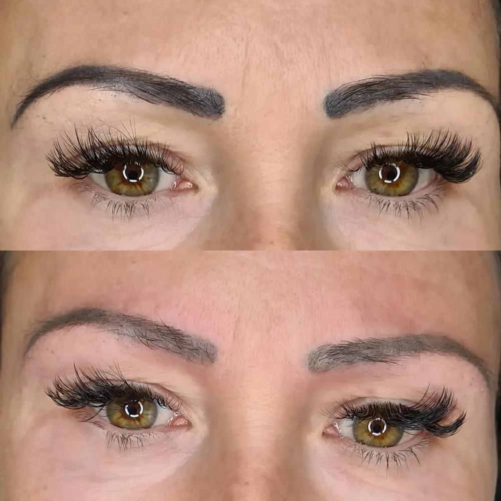 Îndepărtare tatuaj sprâncene cu laser ND:Yag Q-switched la Aliana Beauty în Timișoara, rezultat după o ședință